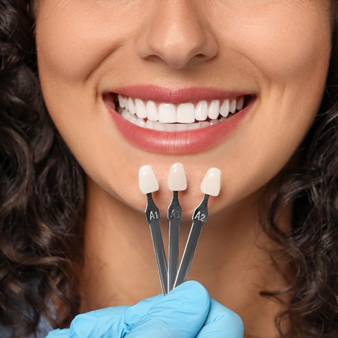 Nose-to-neck view of woman smiling with 3-pronged shade guide held to her teeth